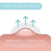 Stylpro Hydrocolloid & Salicylic Acid Replacement Patches